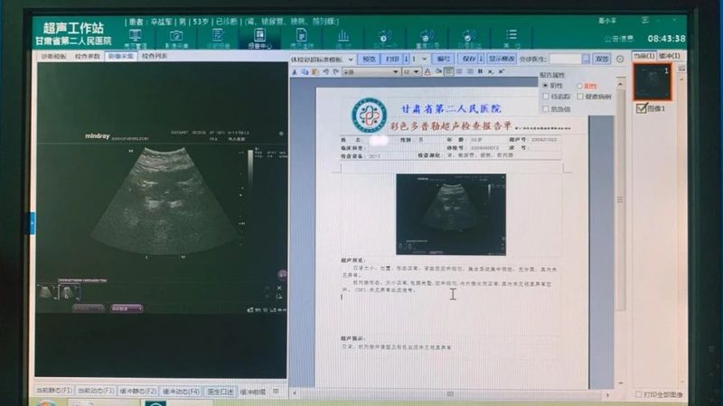 全身体检哪家医院好推荐